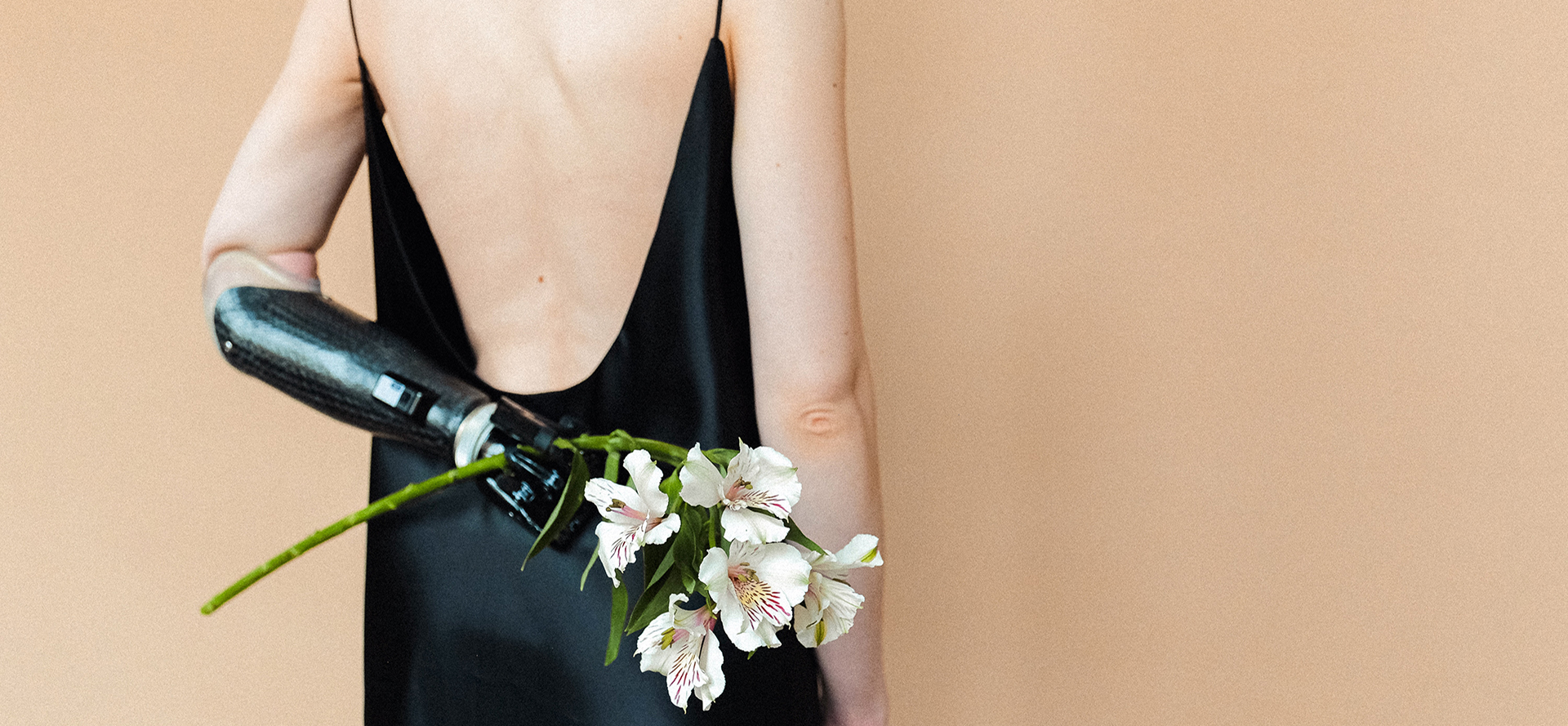 Disabled woman with a bionic hand holding a bouquet of flowers.